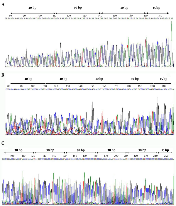 Sequencing results of PCR products of MAOA-uVNTR. Electropherogram of alleles showing 3.5 (A), 4.5 (B) and 5.5 (C) repeats